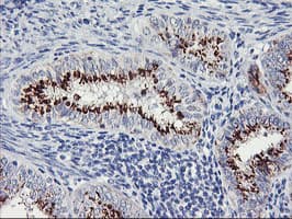 GOLM1 / GP73 / GOLPH2 Antibody (clone OTI2F3)