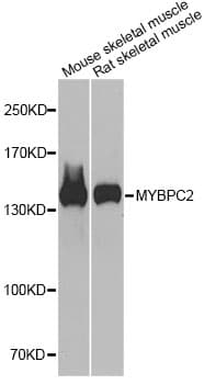 MYBPC2 Antibody
