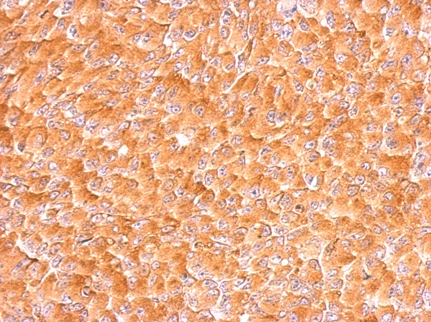 AIMP1 / EMAP II Antibody (aa1-263)