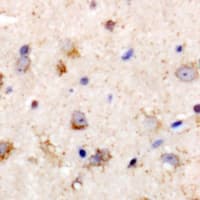 Prostaglandin D Synthase Antibody