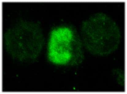 FOXP3 Antibody (clone MF333F)
