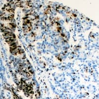 RAP30 / GTF2F2 Antibody
