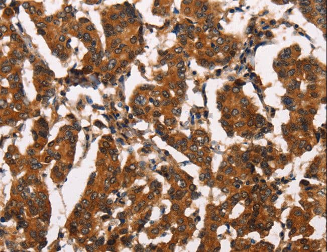 Polyclonal Rabbit anti-Human ATRN / Attractin Antibody (IHC)