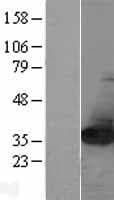 NIT2 Protein (Over-Expression Lysate Myc-DDK (Flag))