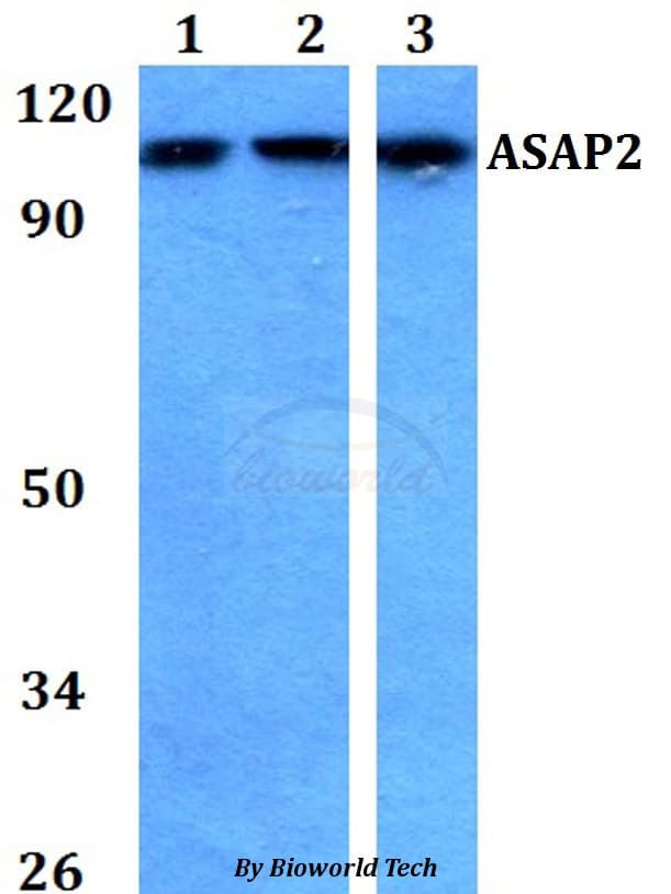 ASAP2 / DDEF2 Antibody
