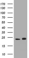 PathPlus™ GSTP1 / GST Pi Antibody (clone OTI4B6)