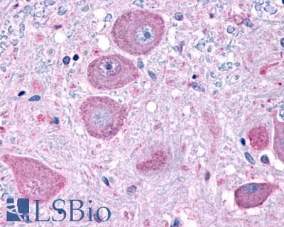 PathPlus™ NPFFR1 / GPR147 Antibody (C-Terminus)