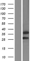 Human TNNT3 Protein (Over-Expression Lysate Myc-DDK (Flag))
