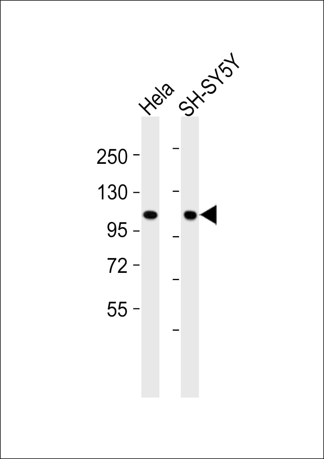 CTNNA1 / Catenin Alpha-1 Antibody
