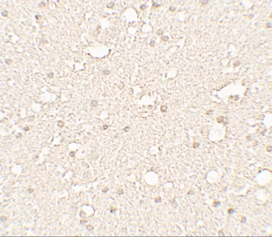 Polyclonal Rabbit anti-Human Alpha Tubulin Antibody (IHC, IF, WB)