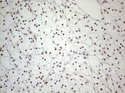 TP53BP1 / 53BP1 Antibody (aa1-300, clone OTI5E1)