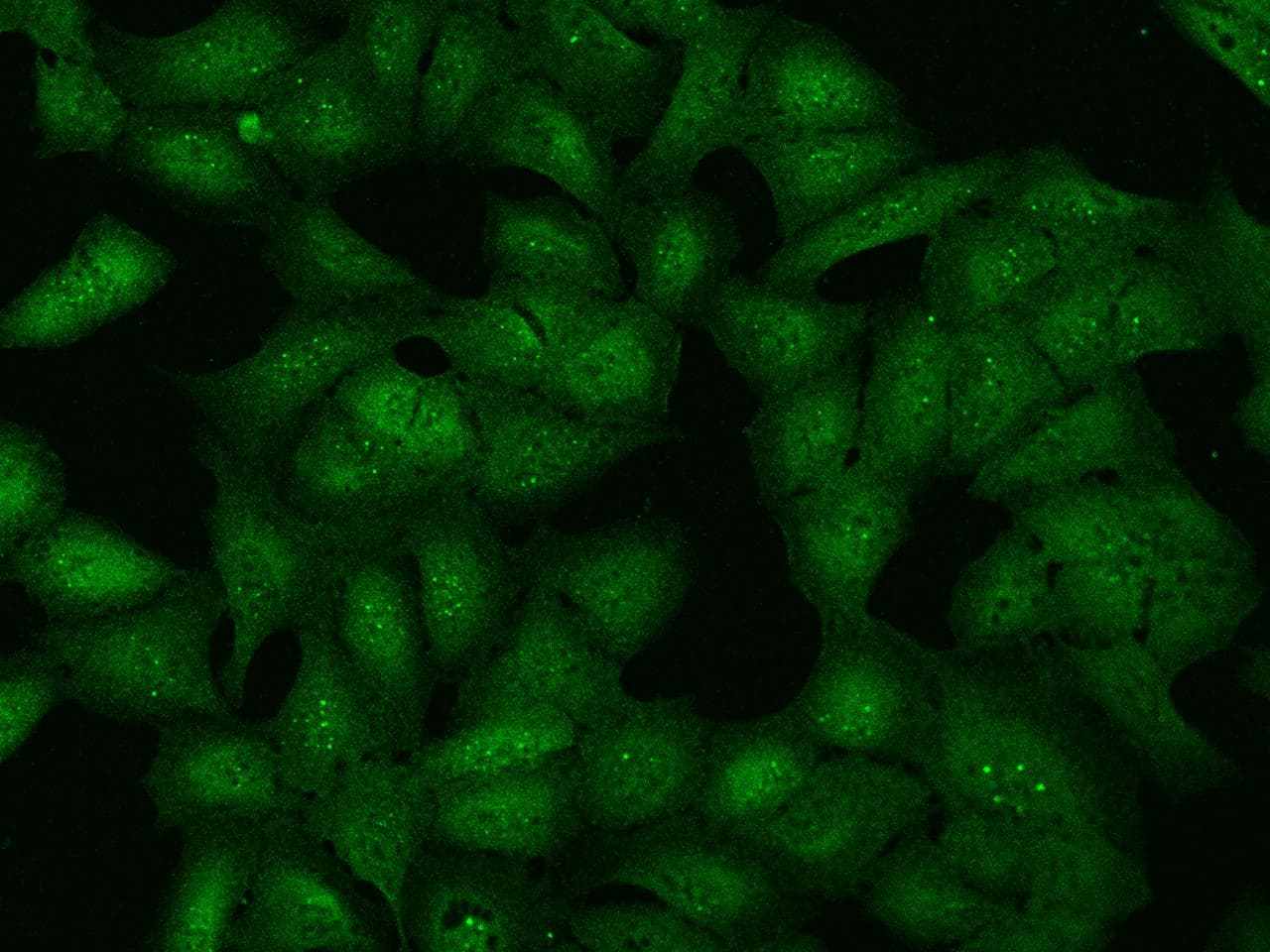 Polyclonal Rabbit anti-Human SH2B3 / LNK Antibody (IHC, IF)