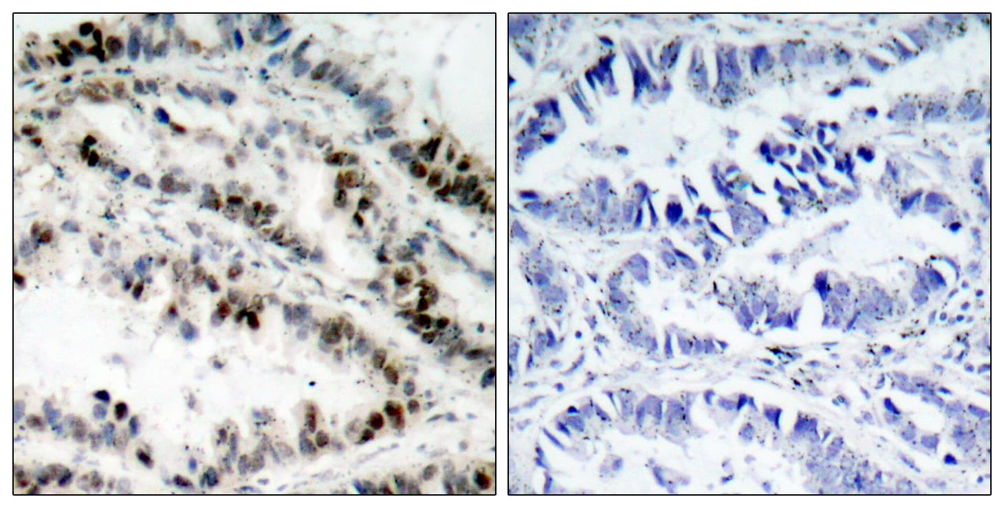 SMC1A / SMC1 Antibody (phospho-Ser957)