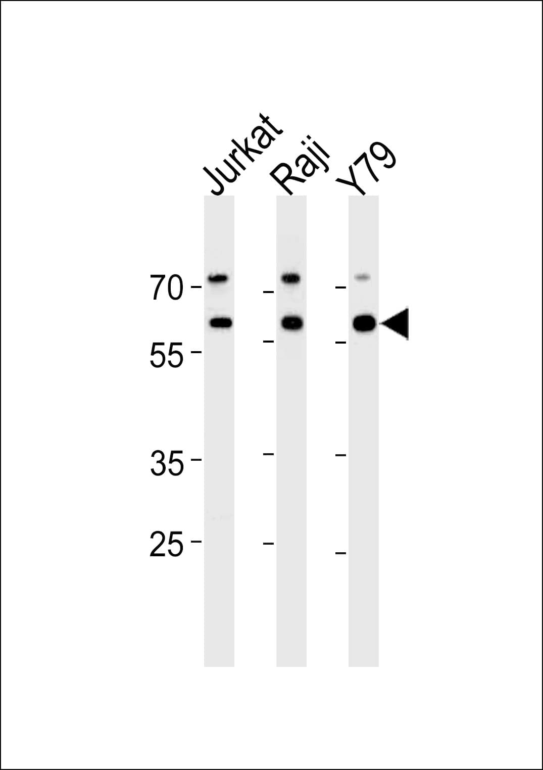 Polyclonal Rabbit anti-Human ACHE / Acetylcholinesterase Antibody (aa147-175, IHC, IF, WB)