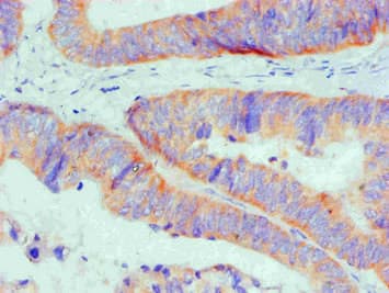 BCL2L1 / BCL-XL Antibody (aa1-209, clone 2C11C2)