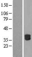 RWDD2B / C21orf6 Protein (Over-Expression Lysate Myc-DDK (Flag))