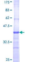 Human CILP Protein (Recombinant GST, N-terminus)