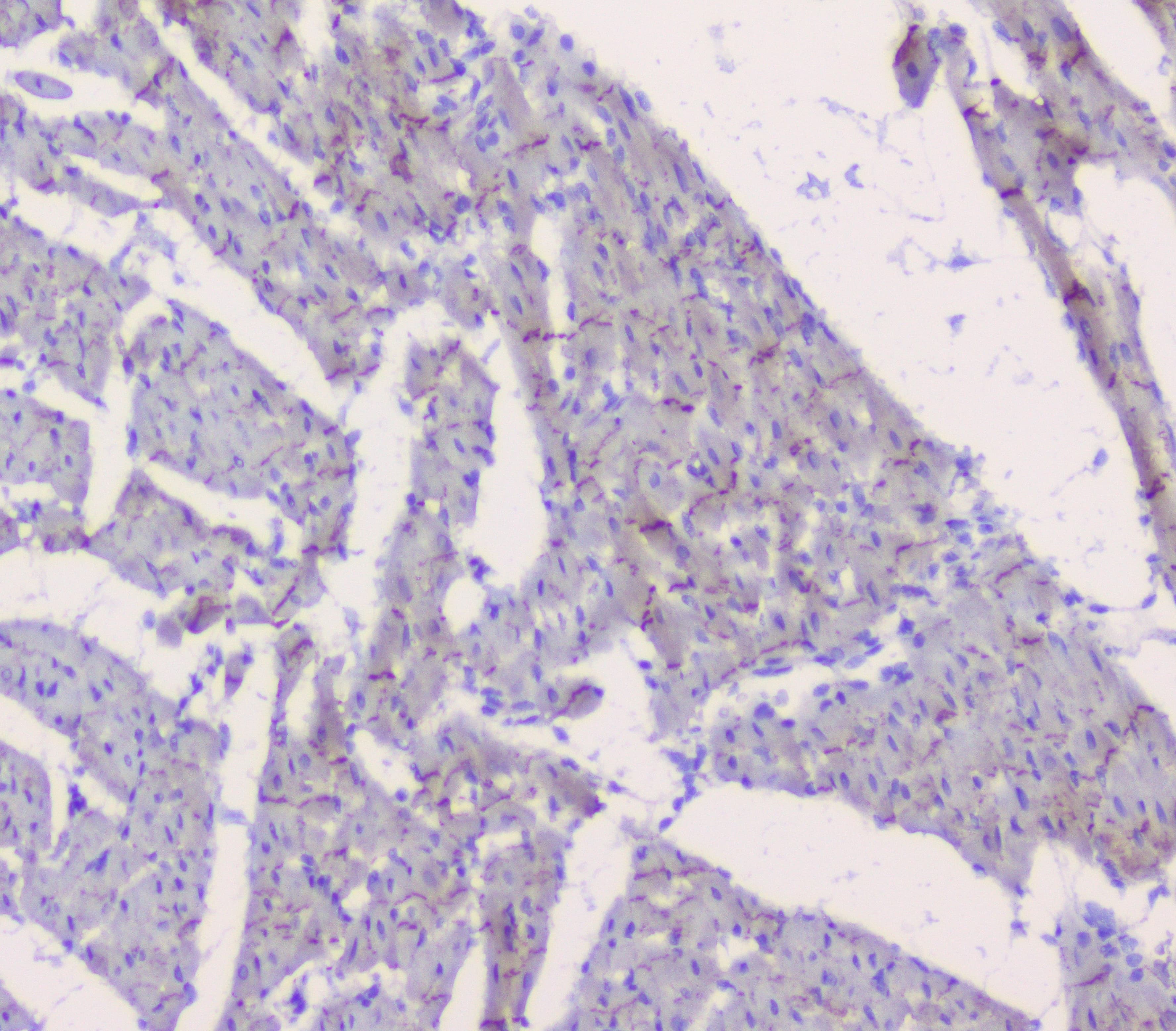 CTNNB1 / Beta Catenin Antibody