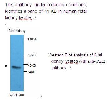 Polyclonal Rabbit anti-Human PAX2 Antibody (WB)