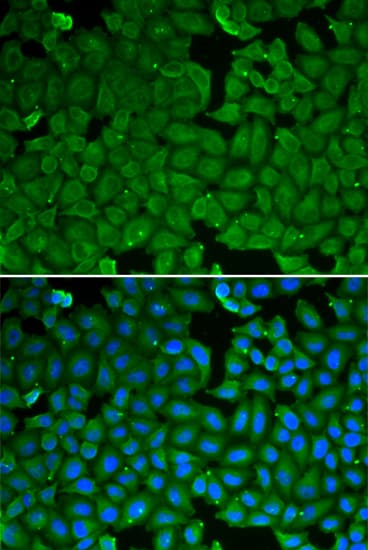 SPINK1 Antibody