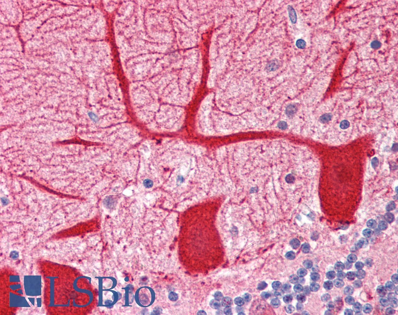IHC-plus™ Polyclonal Rabbit anti-Human OPTN / Optineurin Antibody (aa559-575, IHC, WB)