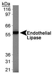 LIPG / Endothelial Lipase Antibody (N-Terminus, DY650)