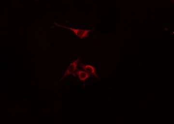 Polyclonal Rabbit anti-Human UBR1 Antibody (IF, WB)