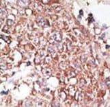 LYVE1 Antibody (aa243-272)