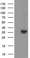 RDH14 Antibody (clone OTI1A7)