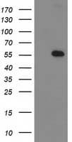 Monoclonal Mouse anti-Human TP53 / p53 Antibody (clone OTI3G9, IHC, IF, WB)