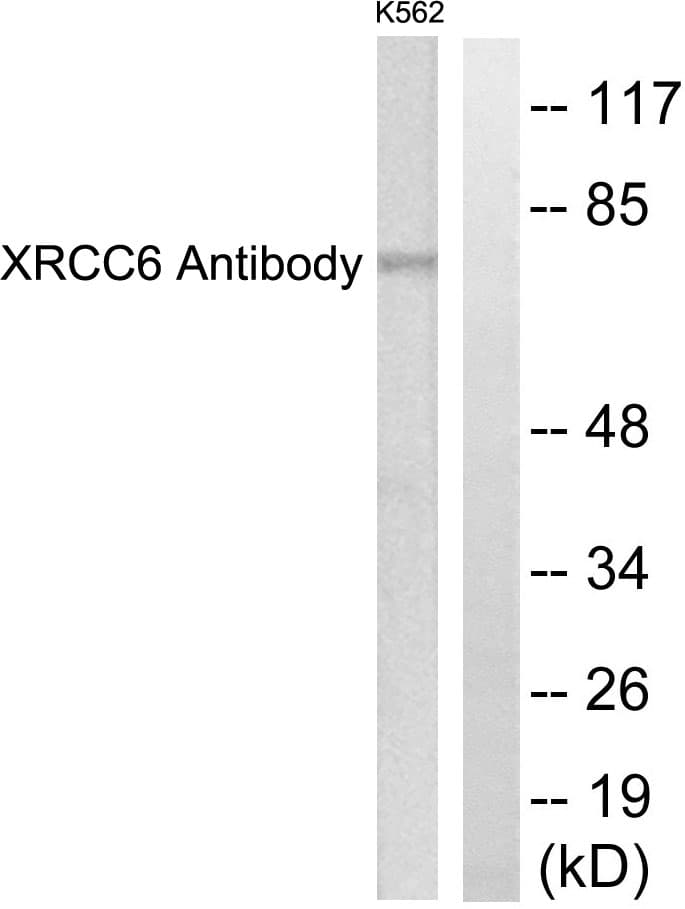 XRCC6 / Ku70 Antibody (aa554-603)