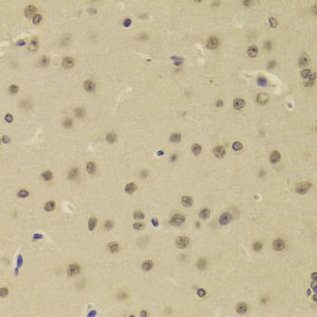 DNTT / TdT Antibody