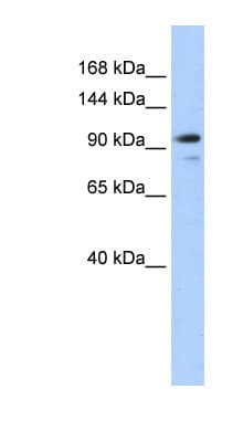 JEAP / AMOTL1 Antibody (aa144-193)