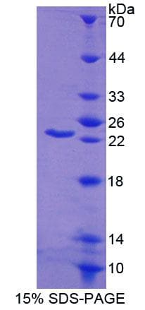 Mouse ABCA9 Protein (Recombinant His-T7, N-terminus)