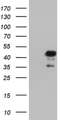 Monoclonal Mouse anti-Human NRBF2 Antibody (clone OTI1C4, WB)