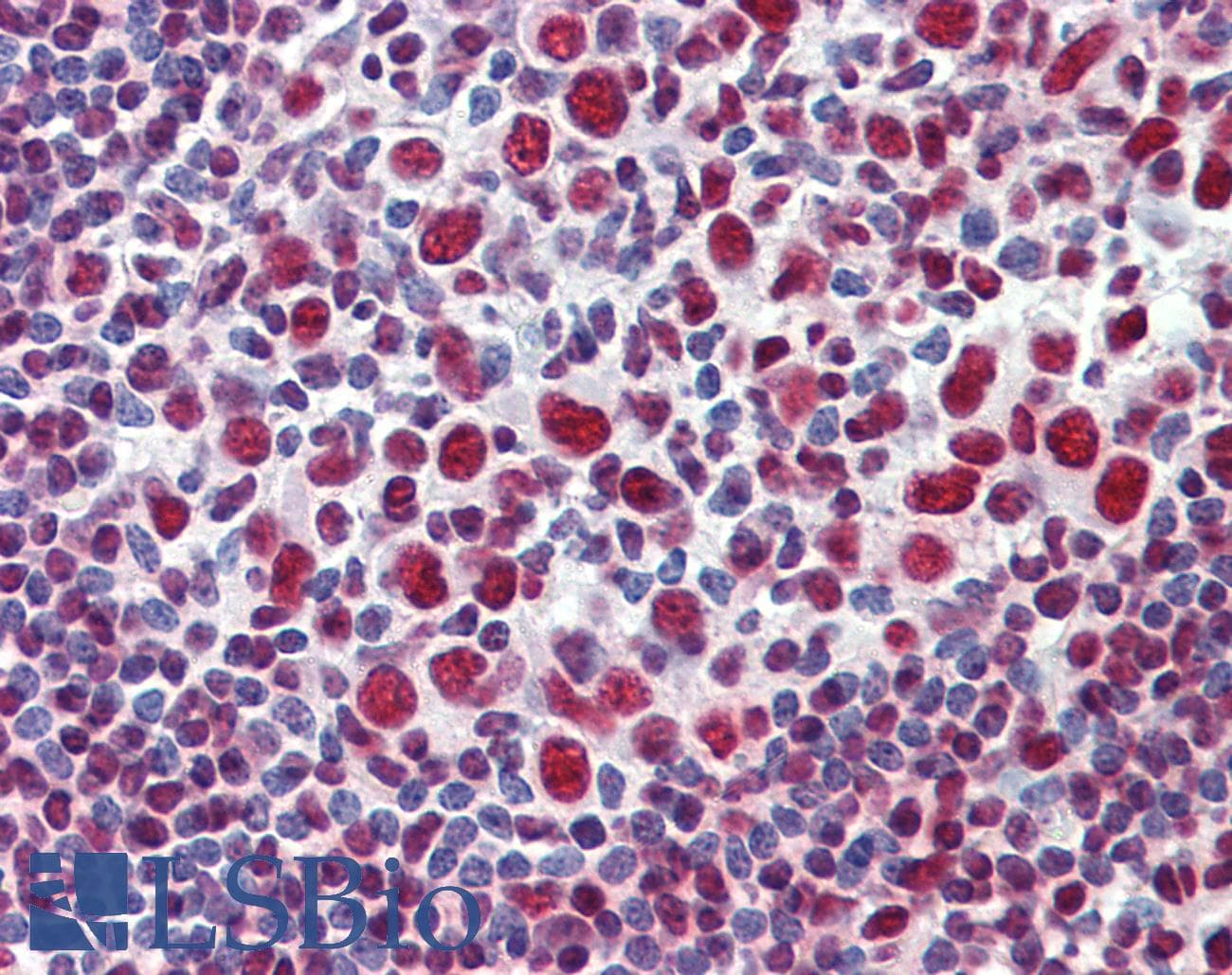 IHC-plus™ Polyclonal Rabbit anti-Human GRB2 Antibody (IHC, WB)