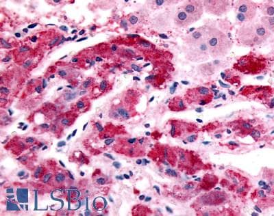 IHC-plus™ Polyclonal Rabbit anti-Human ADRA1B / Adrenoceptor alpha 1B Antibody (C-Terminus, IHC)