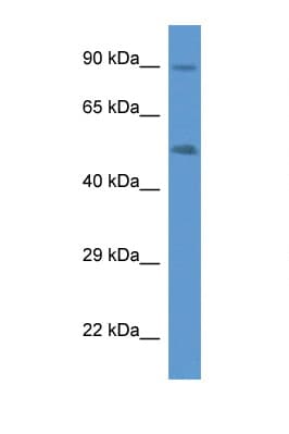 CYP2W1 Antibody (aa260-309)