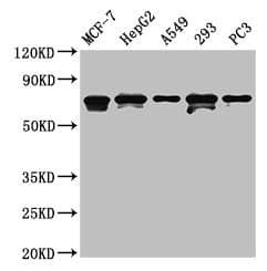 MAGED2 Antibody