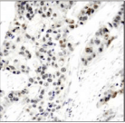 ER Alpha / Estrogen Receptor Antibody