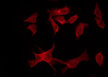 MALT1 Antibody