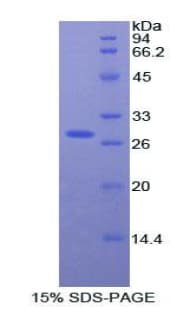Rat AHSG / Fetuin A Protein (Recombinant His)