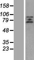 ZBTB20 Protein (Over-Expression Lysate Myc-DDK (Flag))