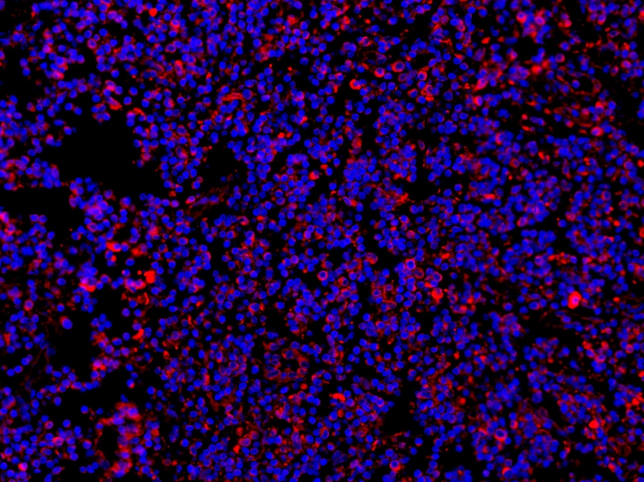 Polyclonal Rabbit anti-Human MYD88 Antibody (aa44-264, IHC, WB)