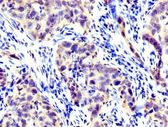 LIM Protein / LPP Antibody