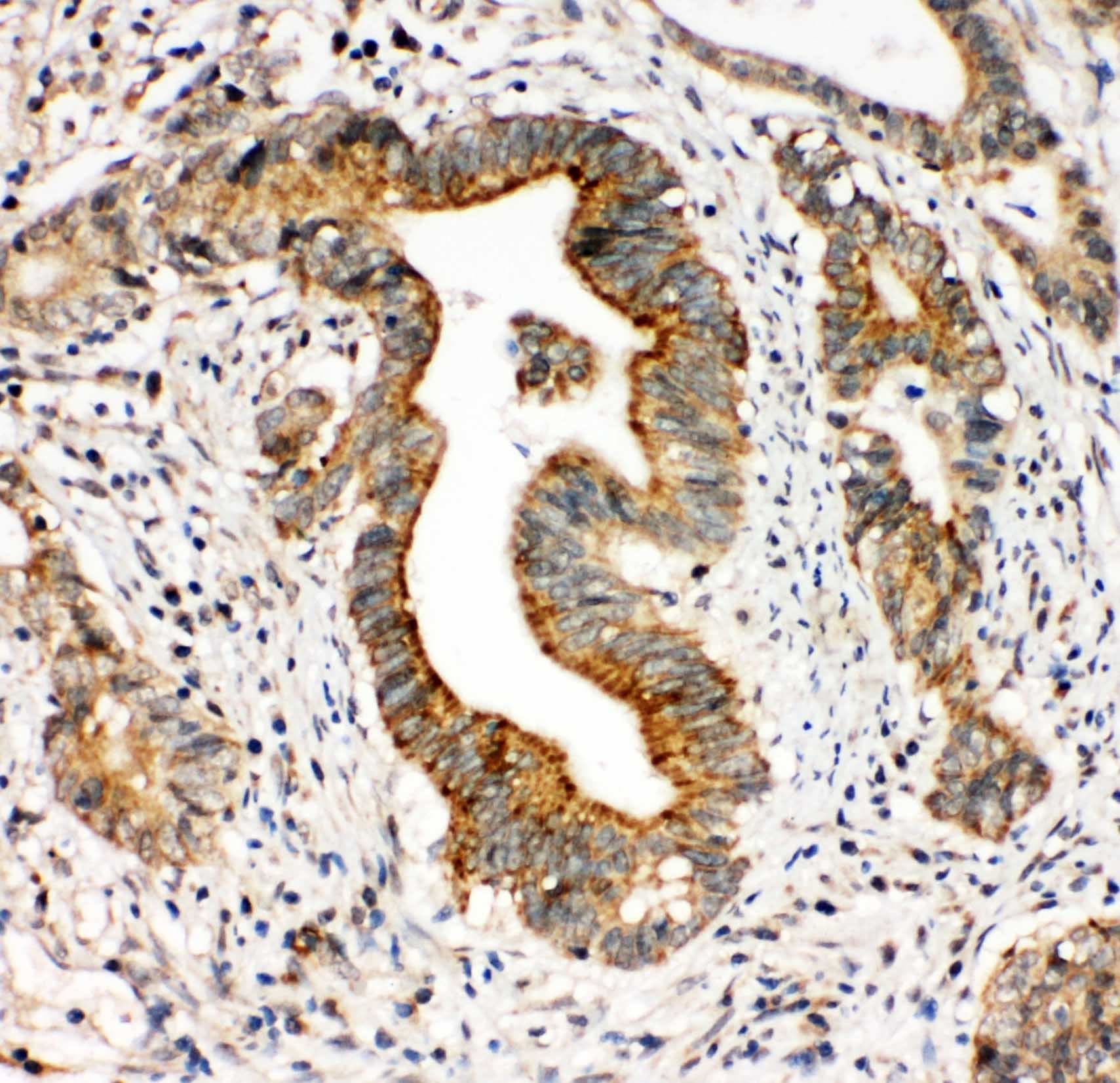 ITGA3 / CD49c Antibody (aa51-67)