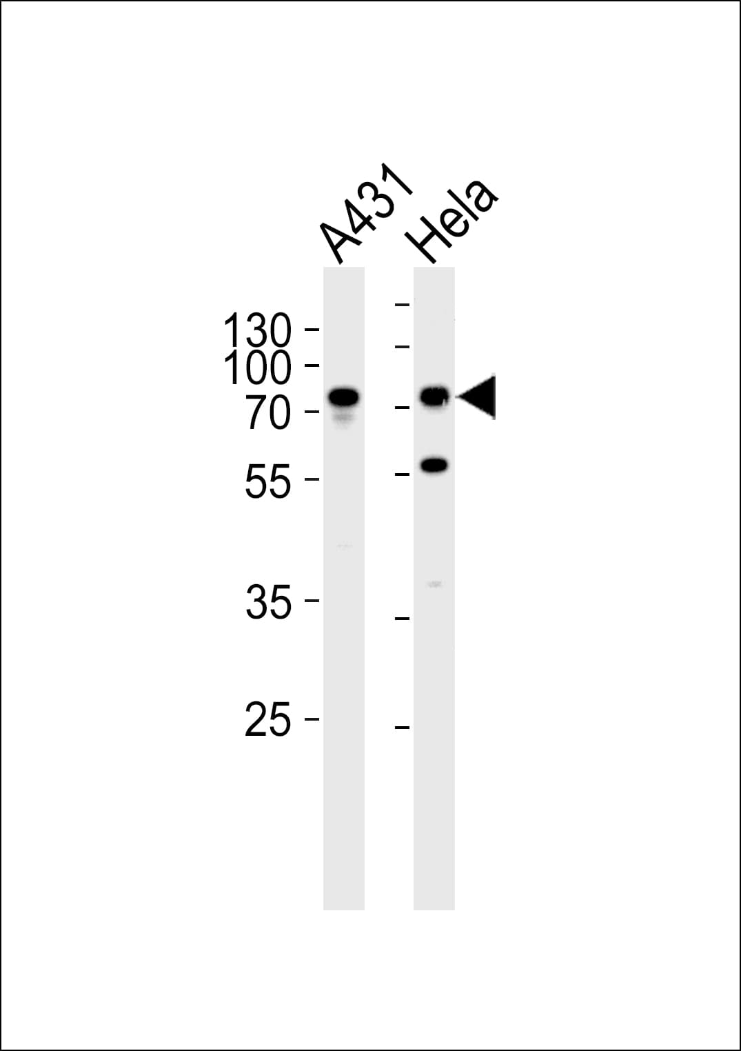 Polyclonal Rabbit anti-Human MAFK Antibody (aa57-85, IHC, WB)
