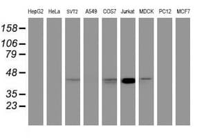 CHST6 Antibody (aa202-395, clone OTI1D1)