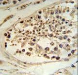 DEK Antibody (aa336-364)