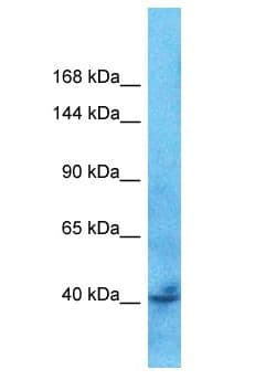 TBC1D9B Antibody (aa340-389)